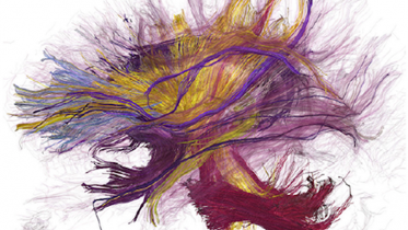 A painted image of a brain.