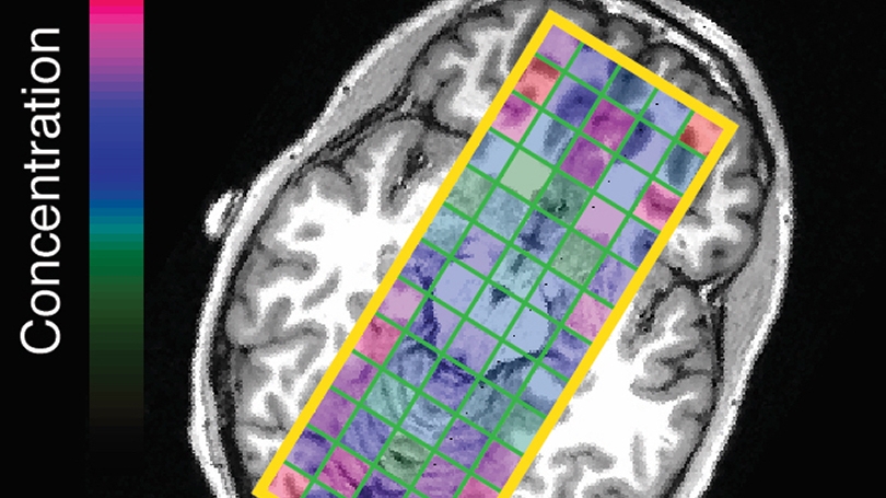 An image of a brain scan.